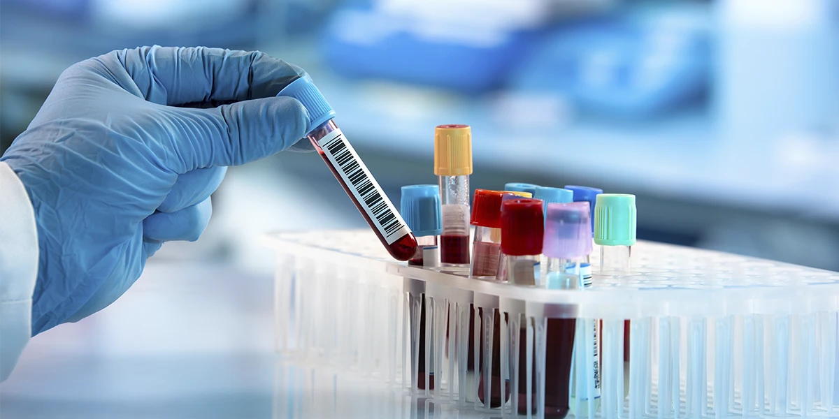 Muestra de sangre siendo colocada en tubos de ensayo para análisis hematológicos en Inoventis Labs, laboratorio en Nuevo Laredo.